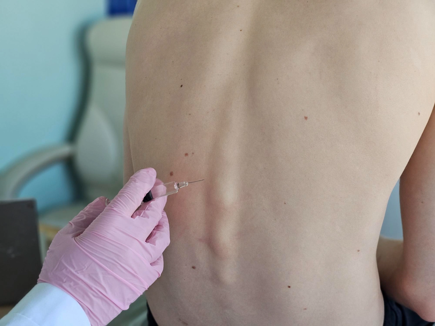 Ultrasound Guided Spinal Injections